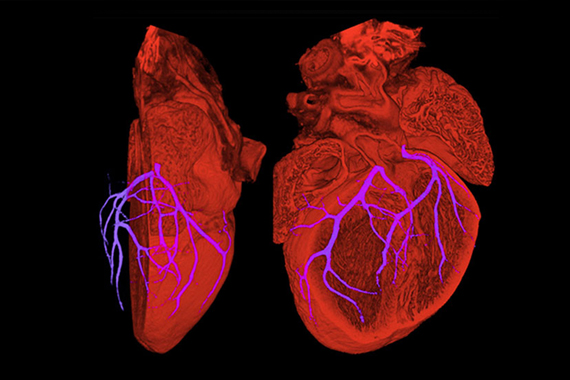 Image of a heart