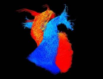 MRI image of a heart