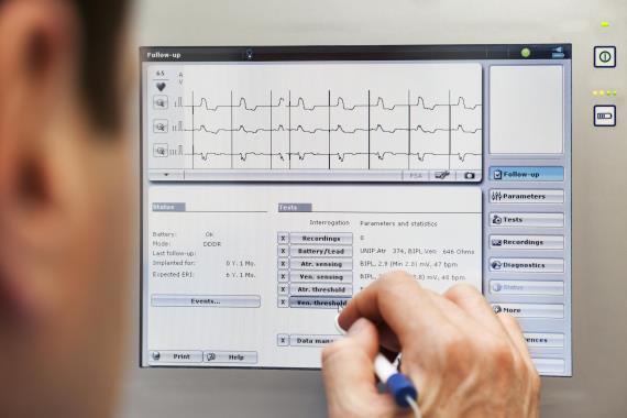 Doctor checking heart monitor data on a computer
