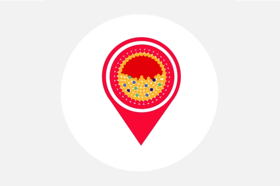 iMAP moving graphic