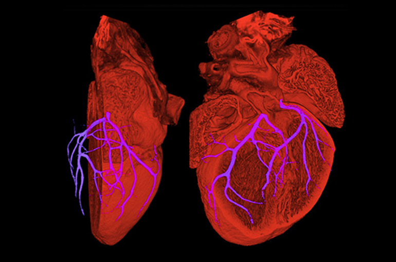 Medical image of a heart