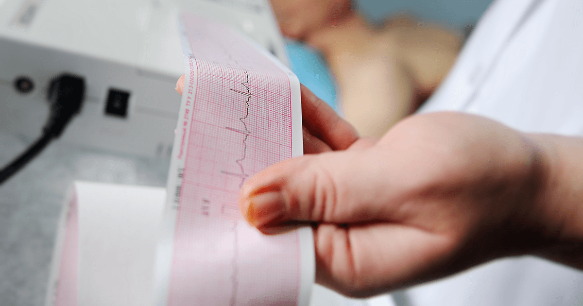 An ECG trace read-out