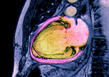 Medical image of a heart