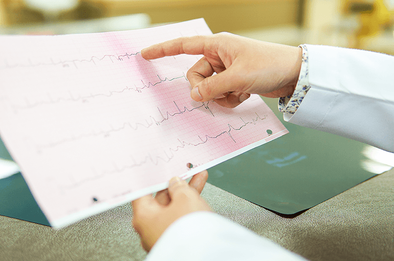 An electrocardiogram trace