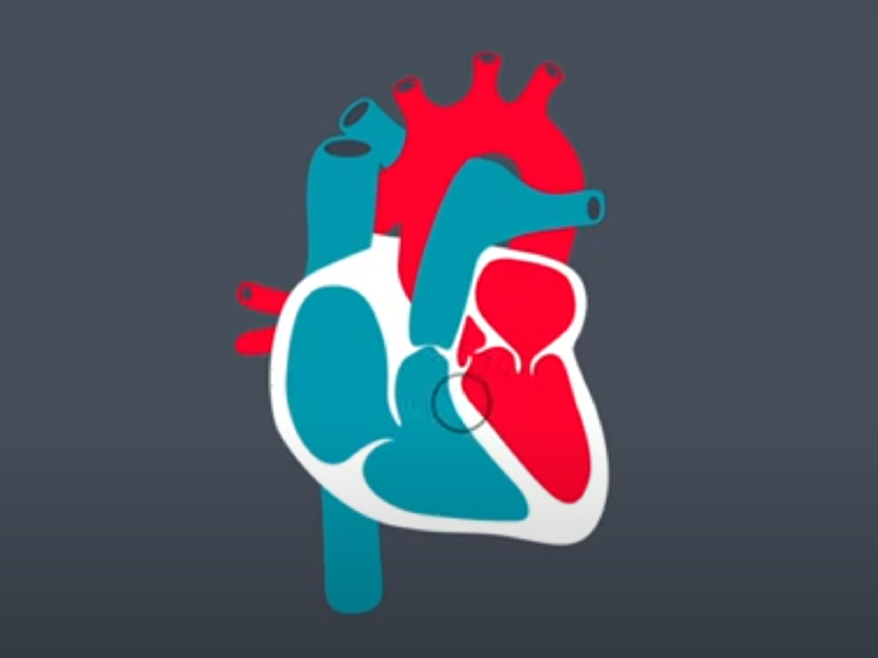 congenital heart conditions