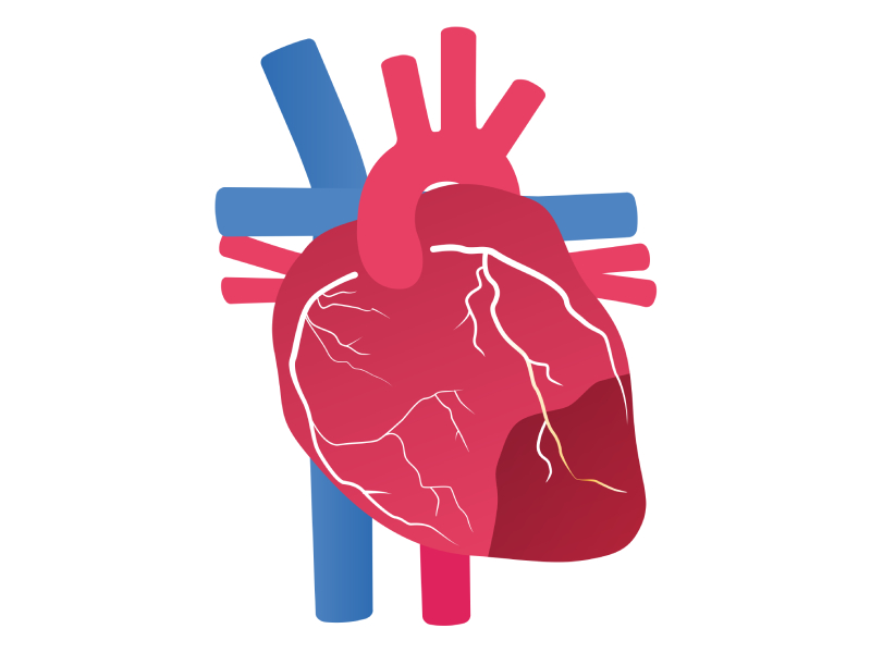 heart attack illustration