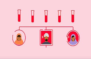 Atherosclerosis - symptoms, causes, tests, treatments