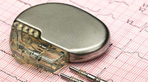 image of a pacemaker