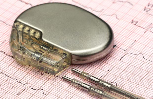 How do implantable loop recorders work? - BHF