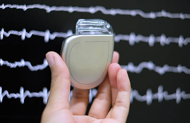 Can a mobile phone interfere with my pacemaker or ICD? - BHF