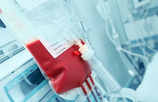Blood in a bag during a blood transfusion
