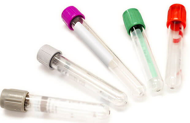 Test tubes with different colour lids