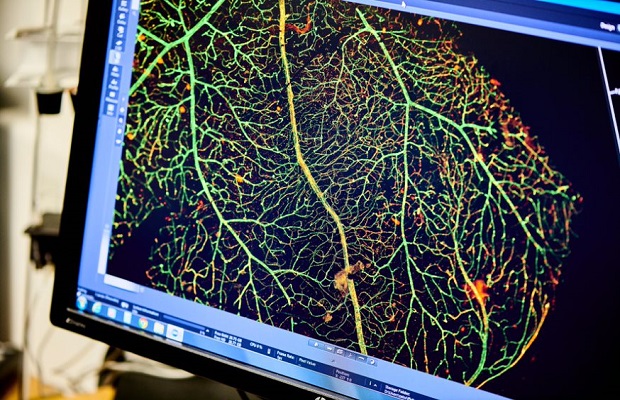 Image of blood vessels on a computer screen