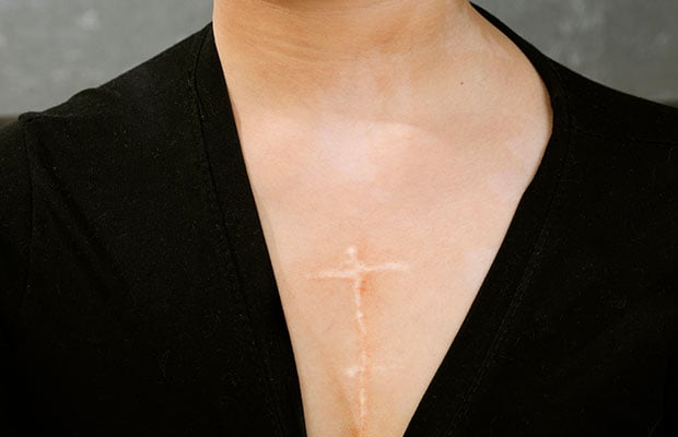 Accepting your changing body after a heart event - BHF