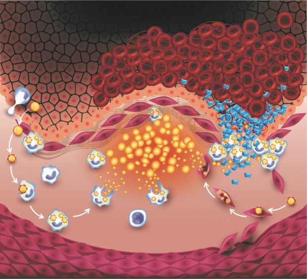 inflammation