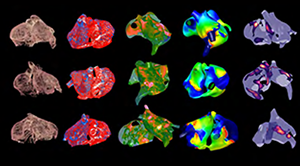 Virtual heart images