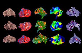 Virtual heart images