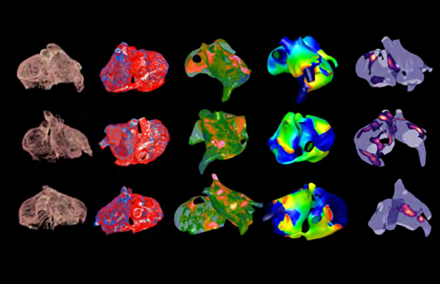 Virtual heart images