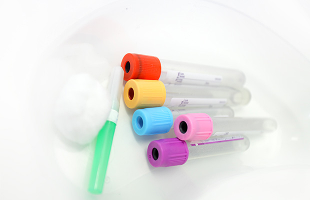 Test bottles with colourful lids and cotton wool on a table.