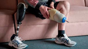 Man with a prosthetic leg sitting on a sofa