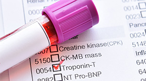 Blood sample tube with request form for a troponin blood test