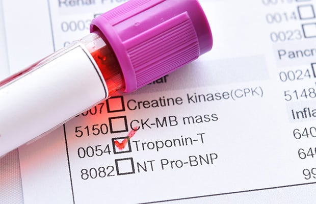 Blood sample tube with request form for a troponin blood test