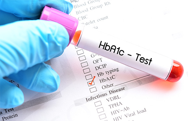 A HbA1c blood test.