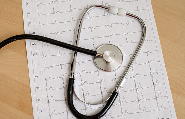A stethoscope on top of ECG test results.