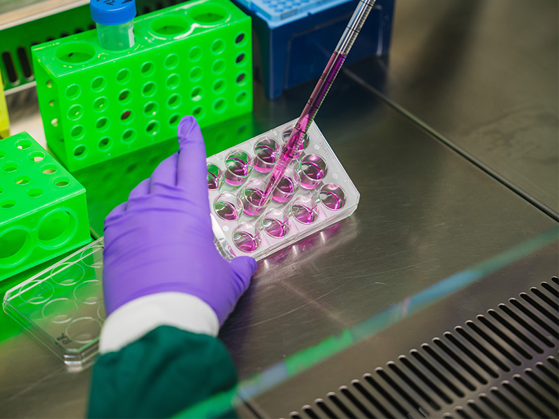 Dr Rikesh Rajani using a pipette as part of his research into vascular dementia treatment.