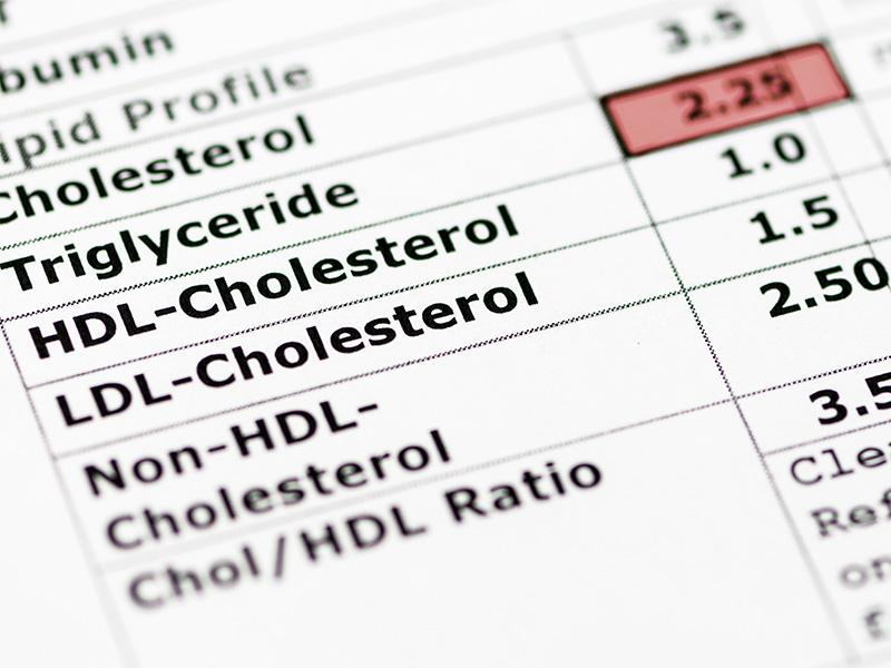 Blood test results showing triglyceride levels.