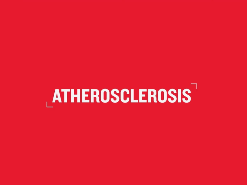 Still from a video explaining atherosclerosis . Text reads: "atherosclerosis".