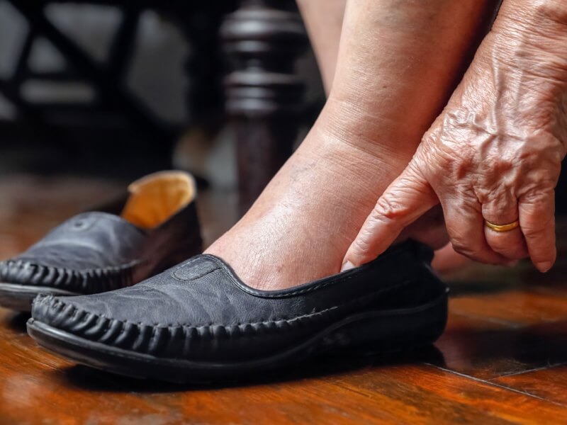 Someone with swollen ankles putting on shoes.