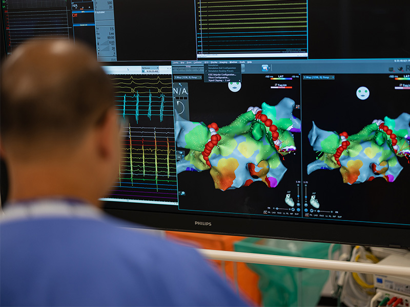 Professor Ng in front a screen showing an ablation.