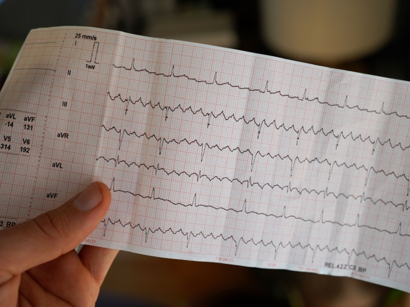 Someone holding an ECG reading which shows atrial flutter.