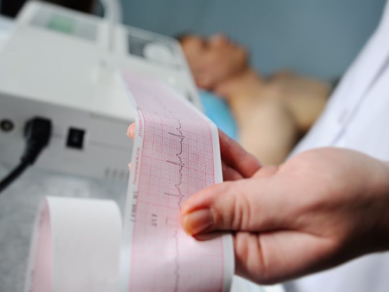 A man having an ECG while a healthcare provider looks at the results.