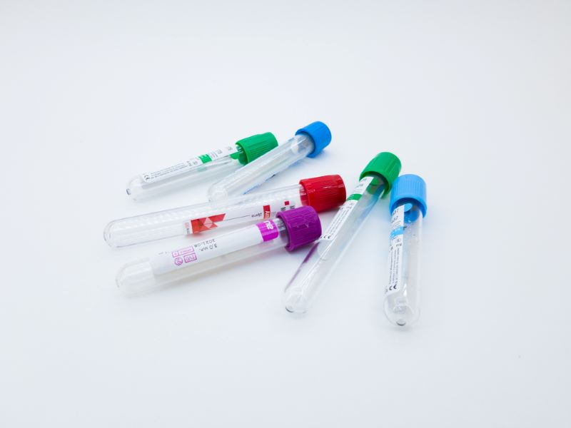 Empty test tubes with different coloured lids