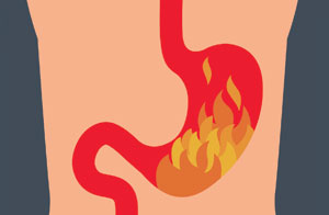 Stomach bursting into flames illustration - Proton pump inhibitors 