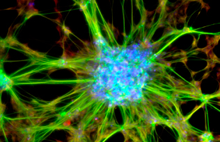 Stem cells