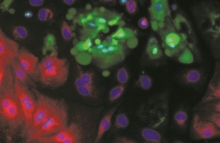 Heart muscle cells derived from stem cells