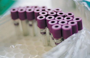 Blood sample bottles