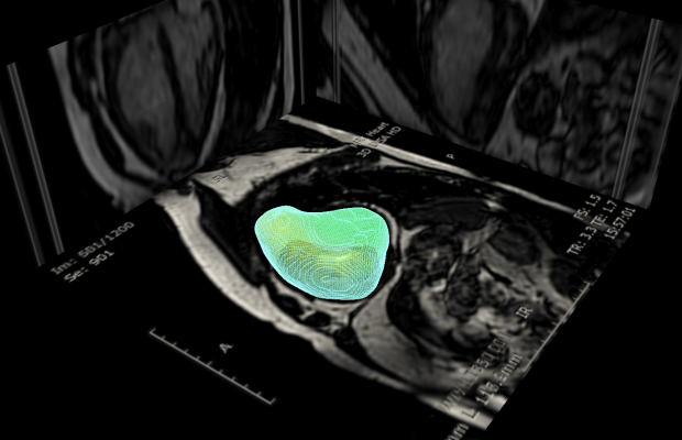 Artificial intelligence 3D heart