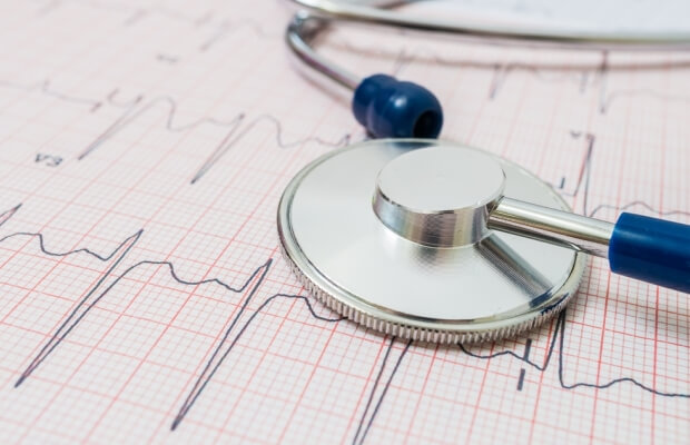 ECG results and a stethoscope