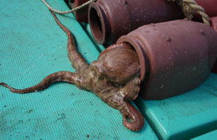 Ventriculography showing cardiac morphology in systole in a patient with takotsubo cardiomyopathy