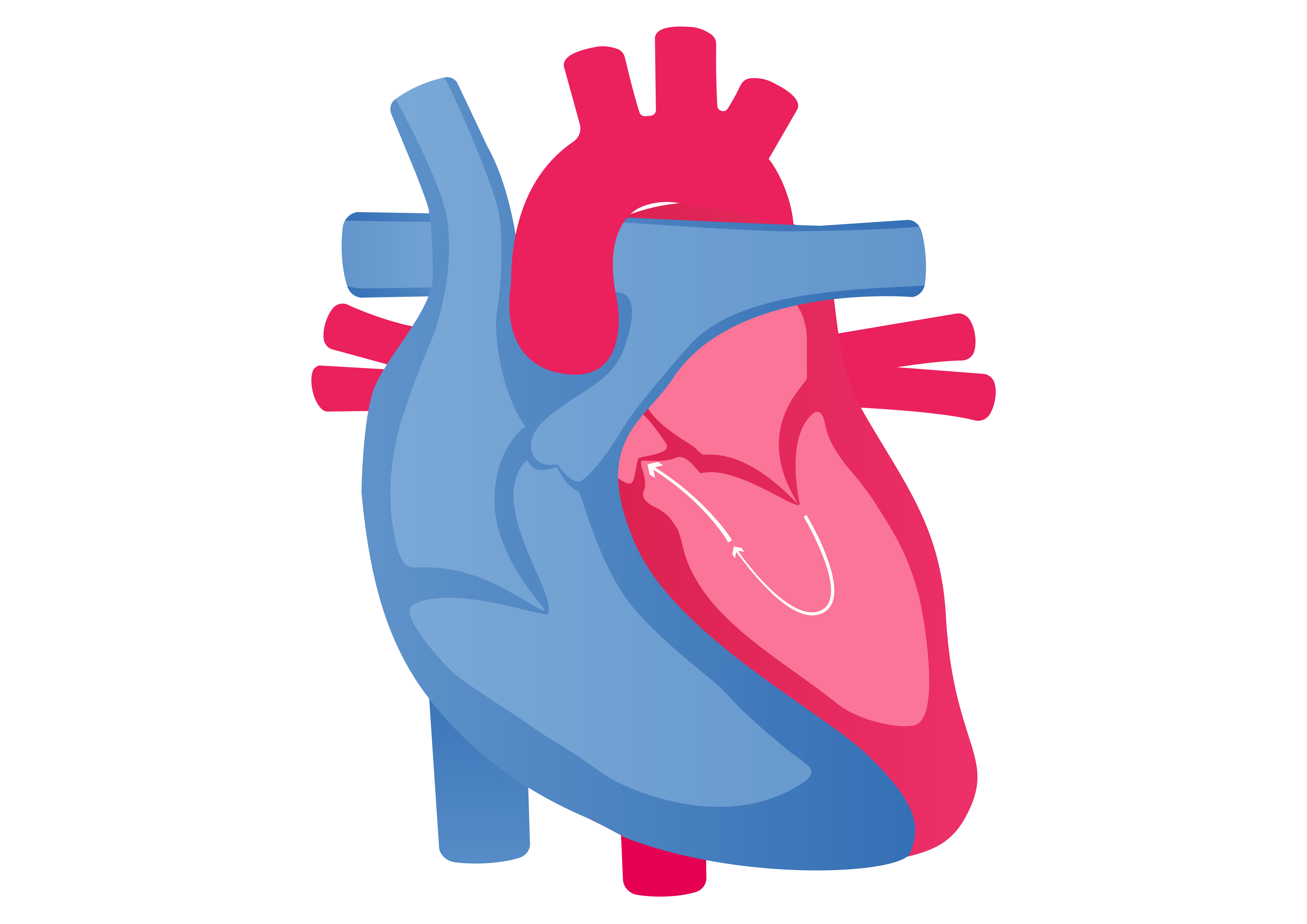 Heart failure with reduced ejection fraction (also known as HFref)