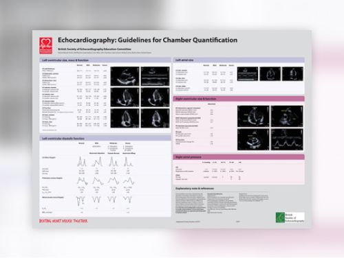 g407_echocardiography_guidelines_for_chamber_quantification_poster_0411