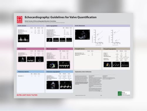 g408_echocardiography_guidelines_for_valve_quantification_poster_0411