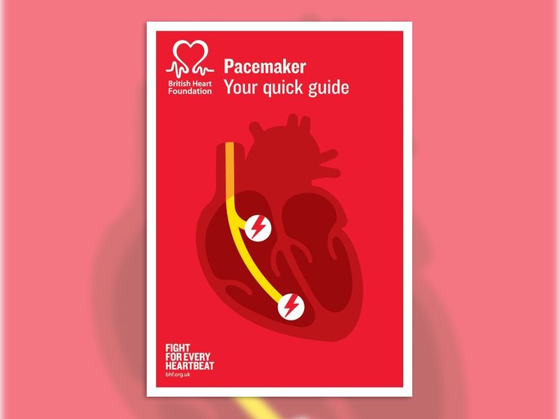 g968_1117_pacemaker_web-qg_1217