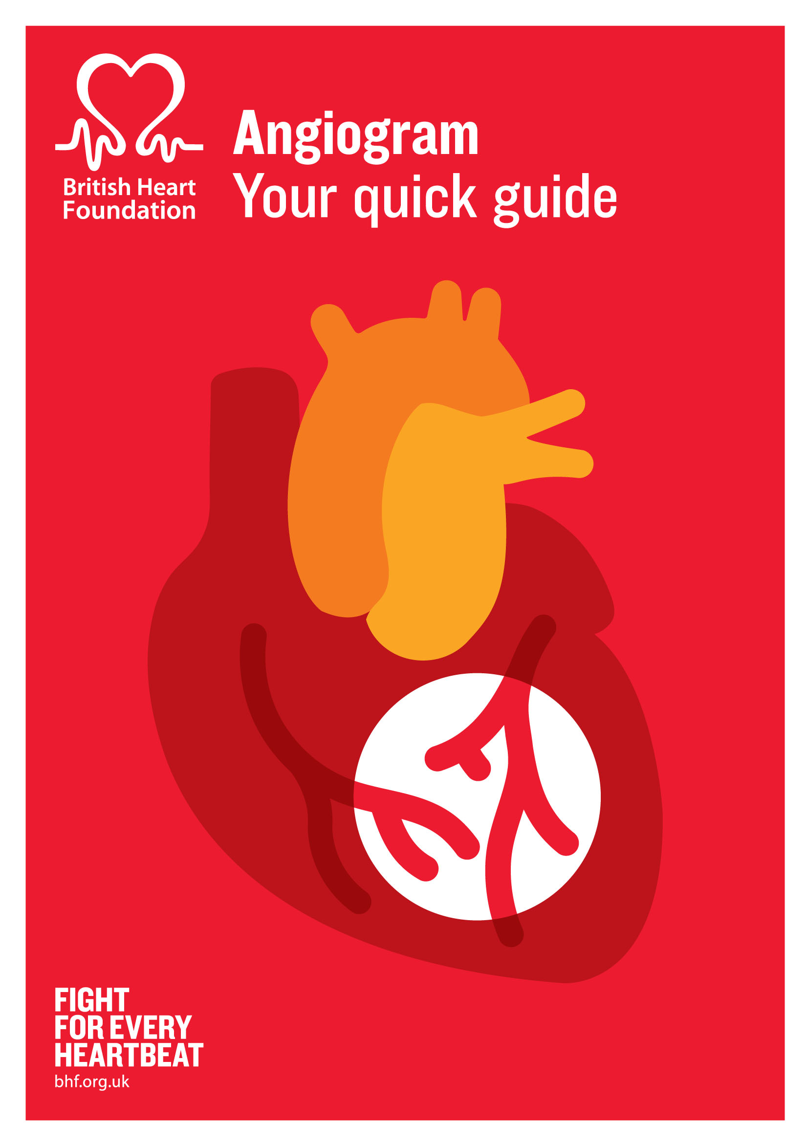 Quick guide to Angiogram - cover image