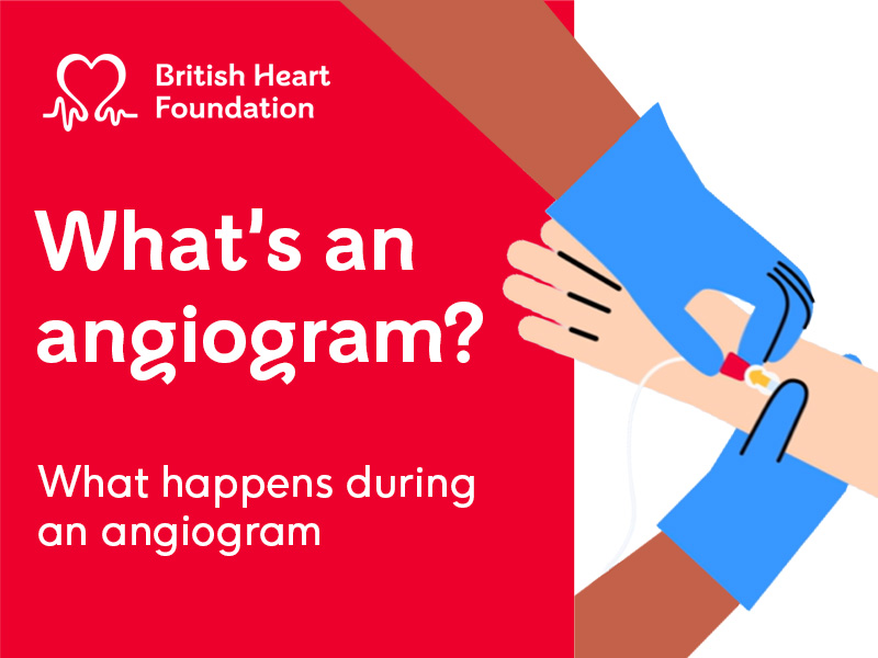 White text on red background reading "What's an angiogram? What happens during aa angiogram". With illustration of a nurses hands removing a catheter from a patient.