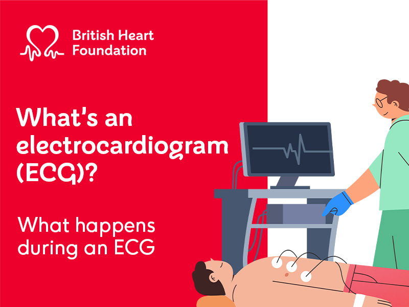 White text on red background reading "What's an electrocardiogram (ECG)? What happens during an ECG". With illustration of a nurse doing an ECG procedure on a patient.